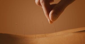 瘰疬是什么病?-岐黄有方